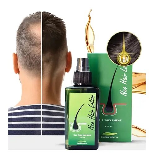 Neo Hair Lotion Oil Green Neo Hair Lotion Oil Green
