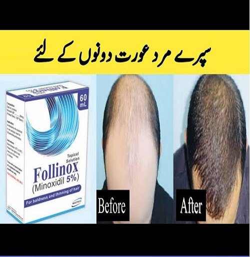 Follinox Minoxidil 5% Follinox Minoxidil 5%